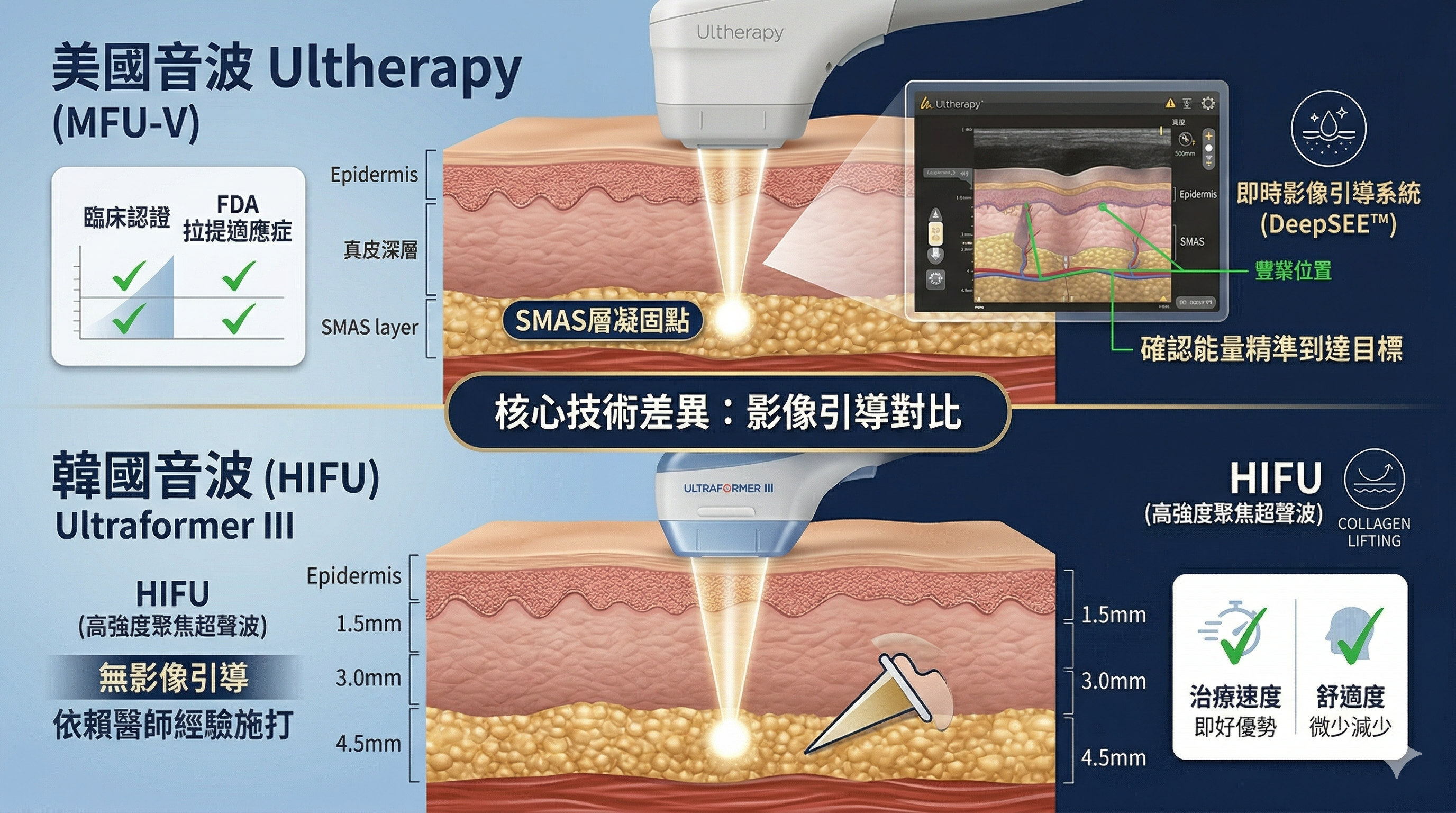 DeepSEE™ vs 無影像引導